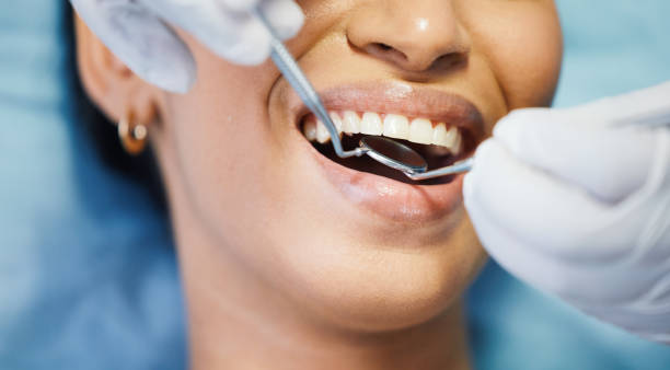 Best Same-Day Dentist Appointment  in Columbus Junction, IA